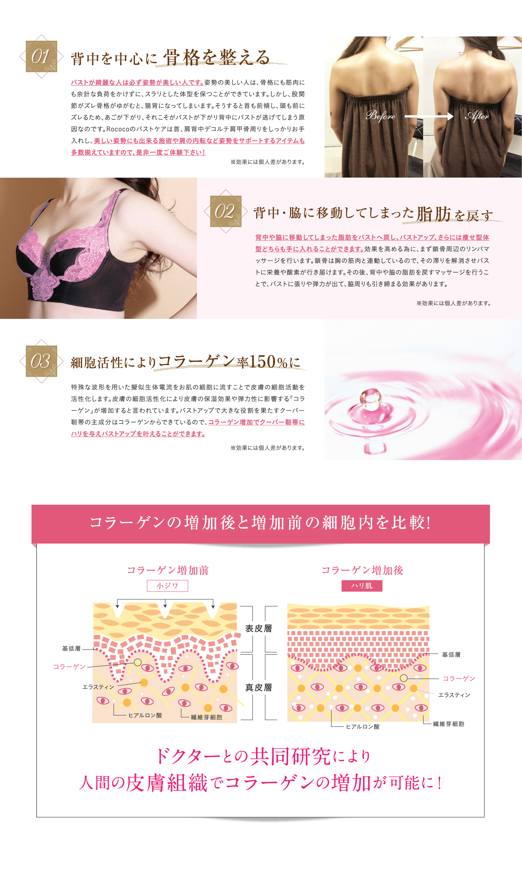 背中を中心に骨格を整える。背中・脇に移動してしまった脂肪を戻す。細胞活性によりコラーゲン率150%に