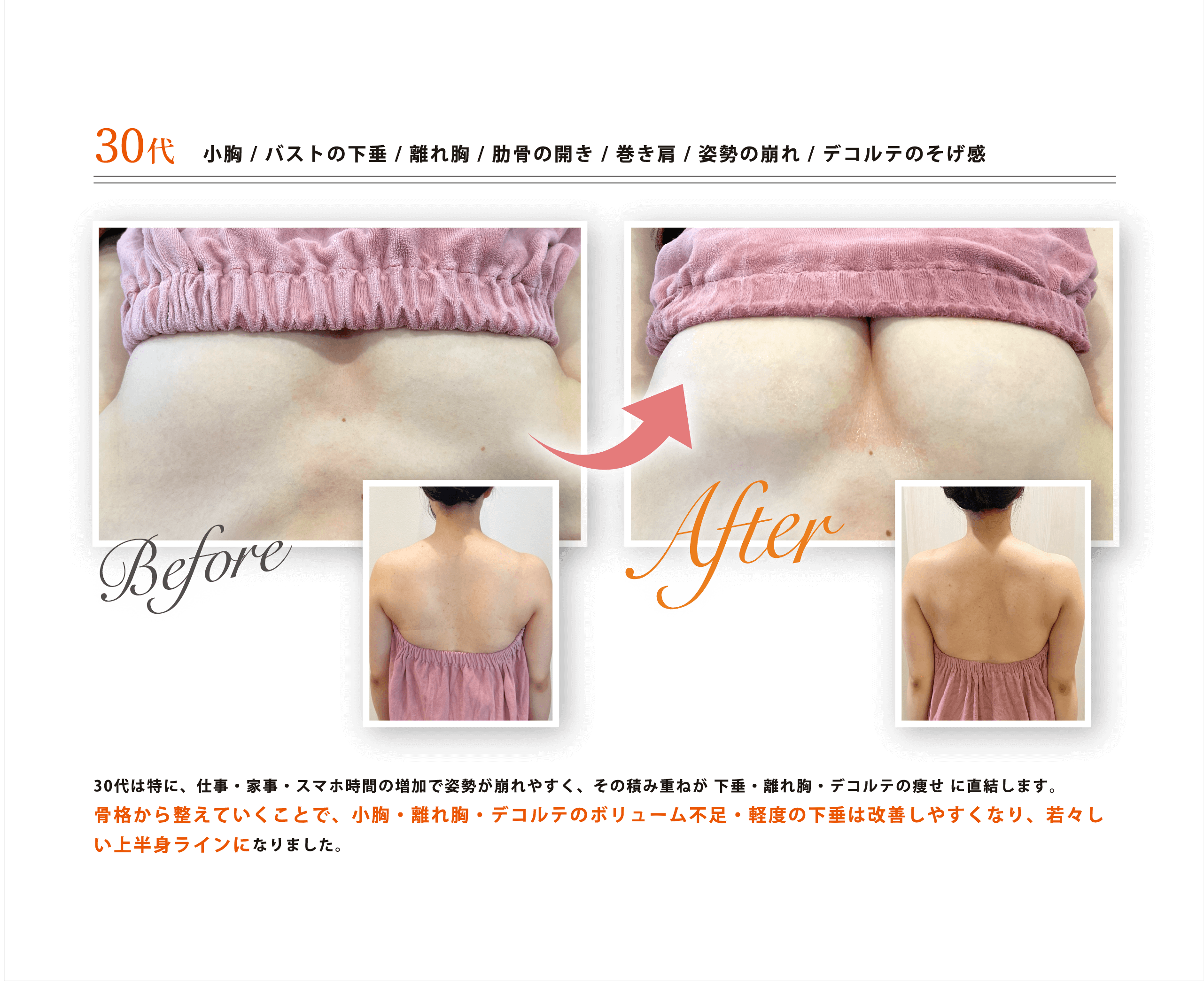 before-after1