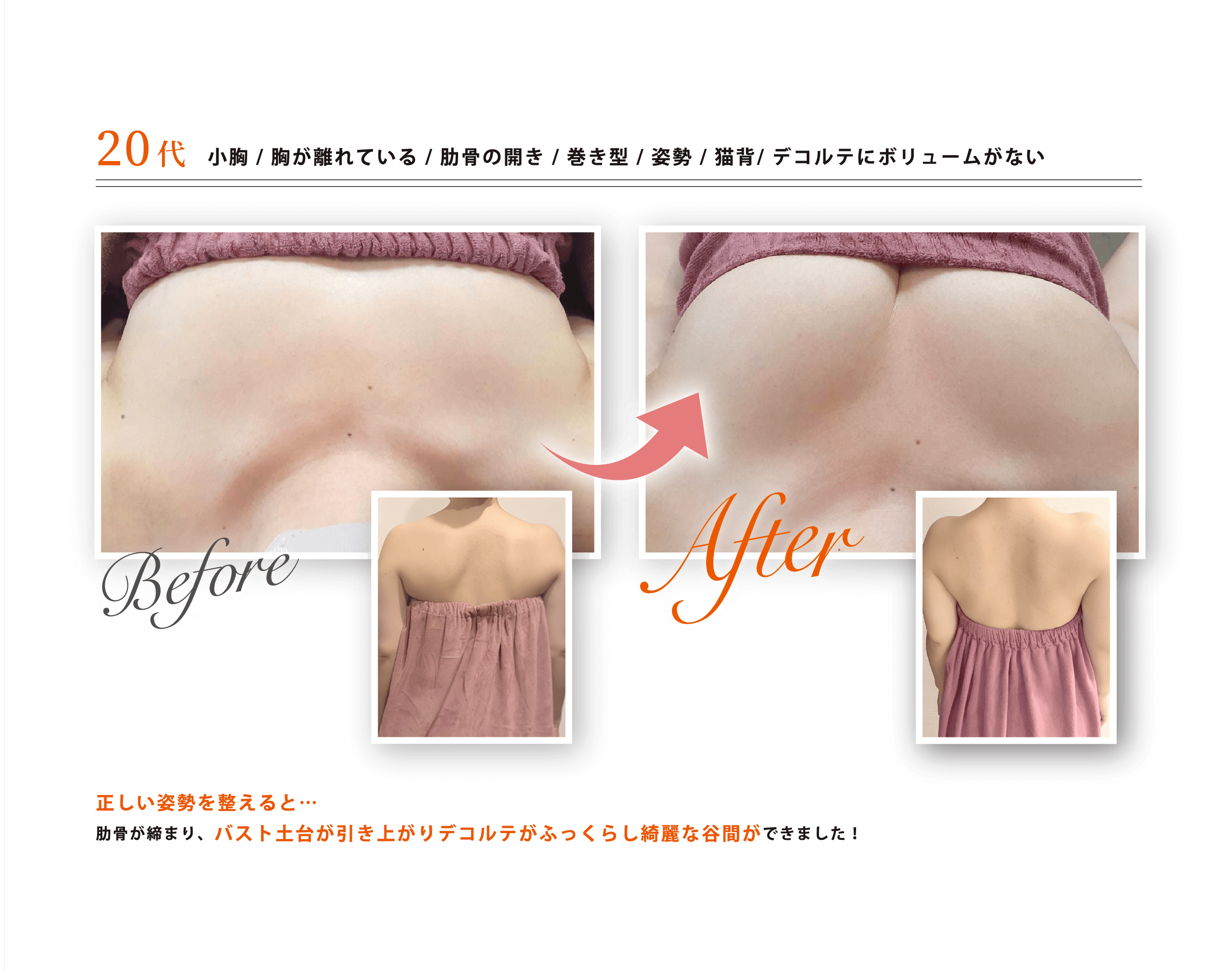 before-after2