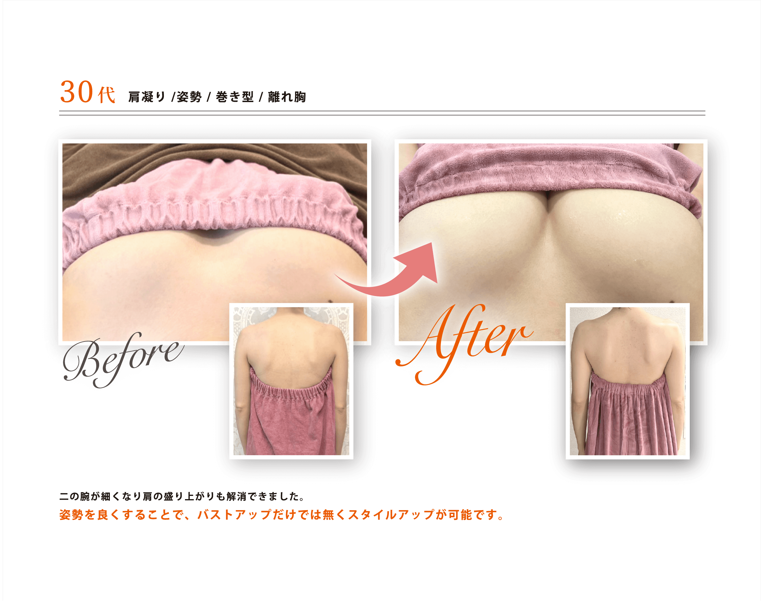 before-after3