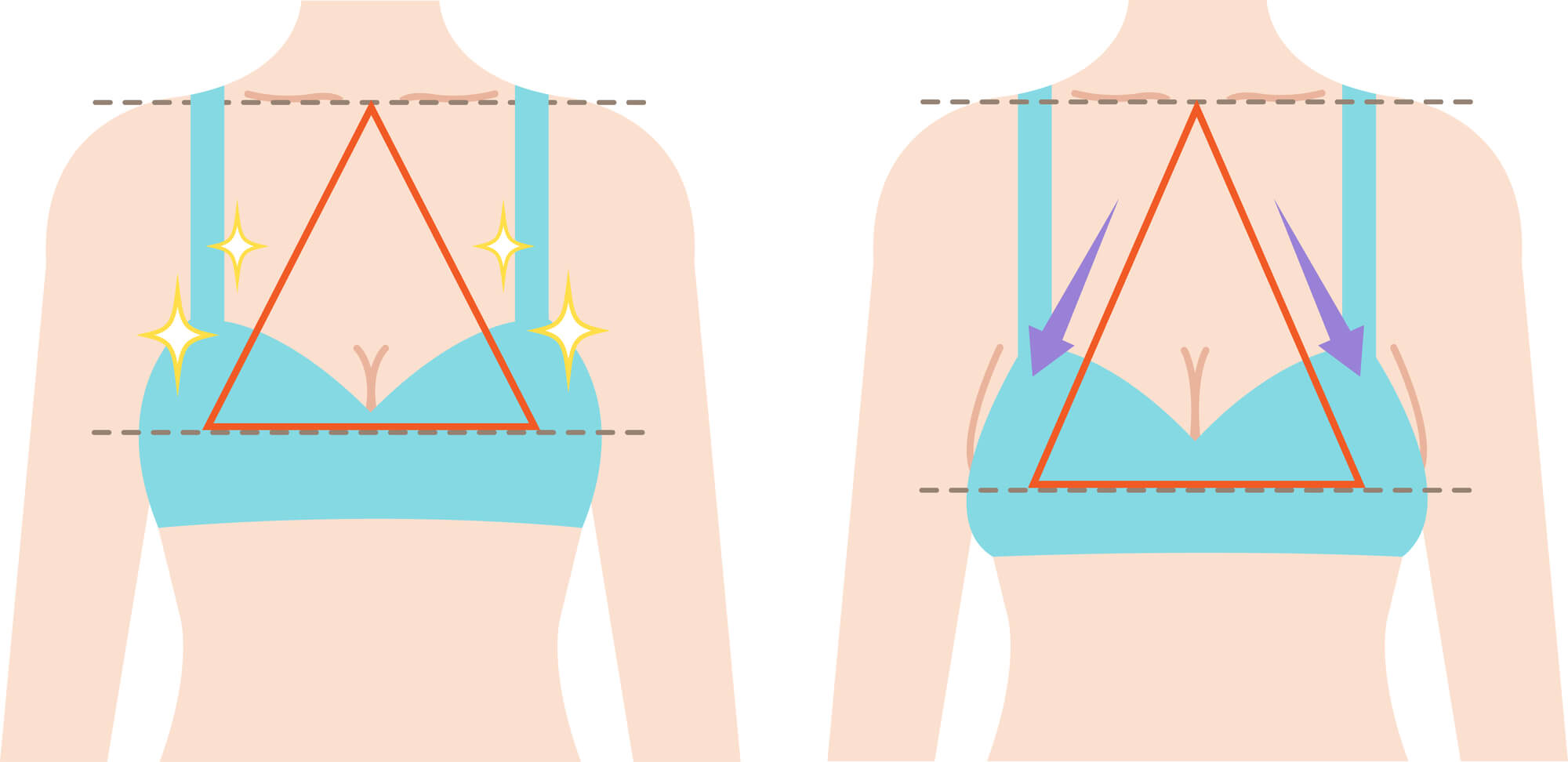 垂れ乳とはどんな状態？